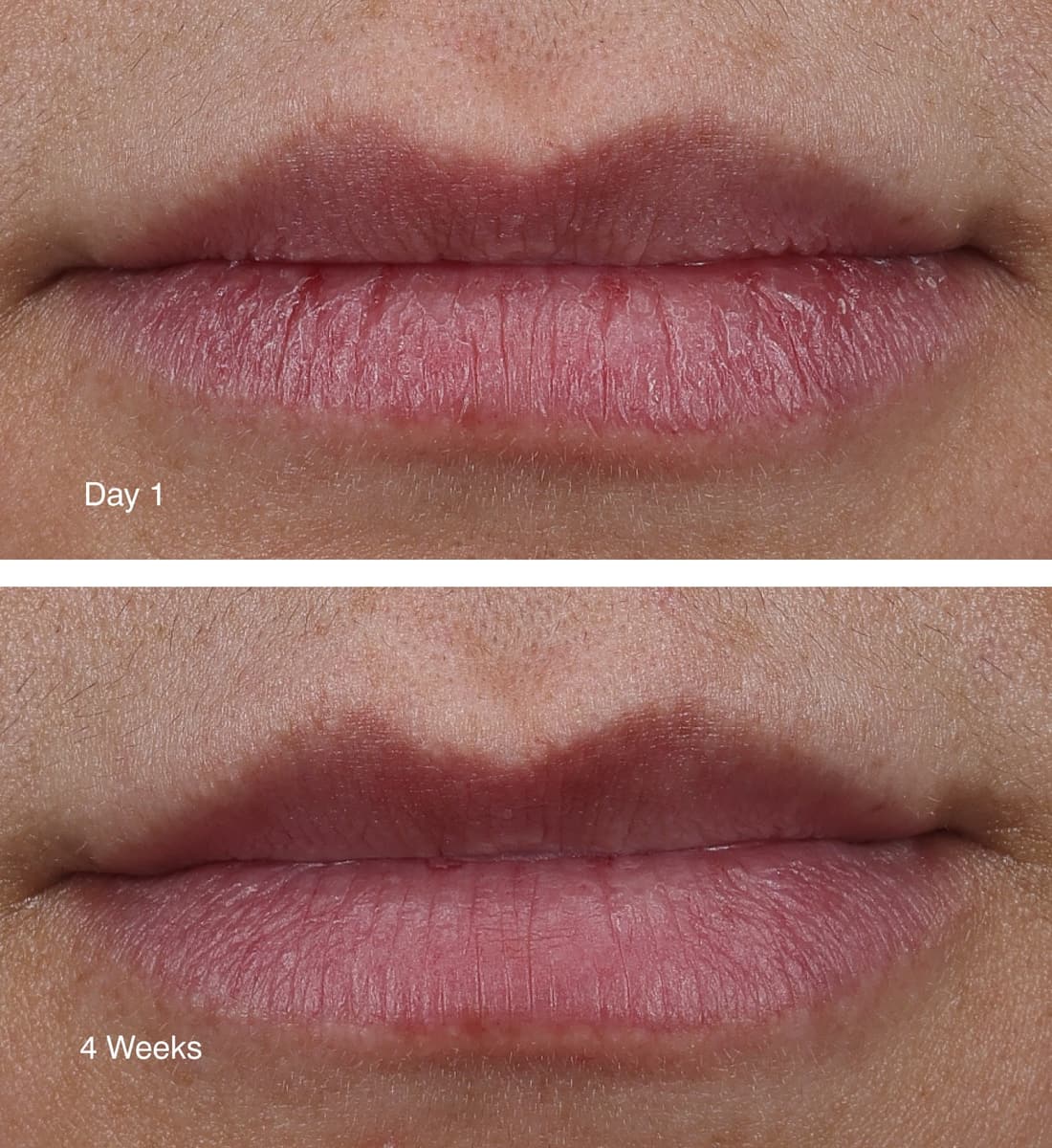 Before and after comparison of lips with 'Day 1' and '4 Weeks' labels after applying peptide lip treatment.
